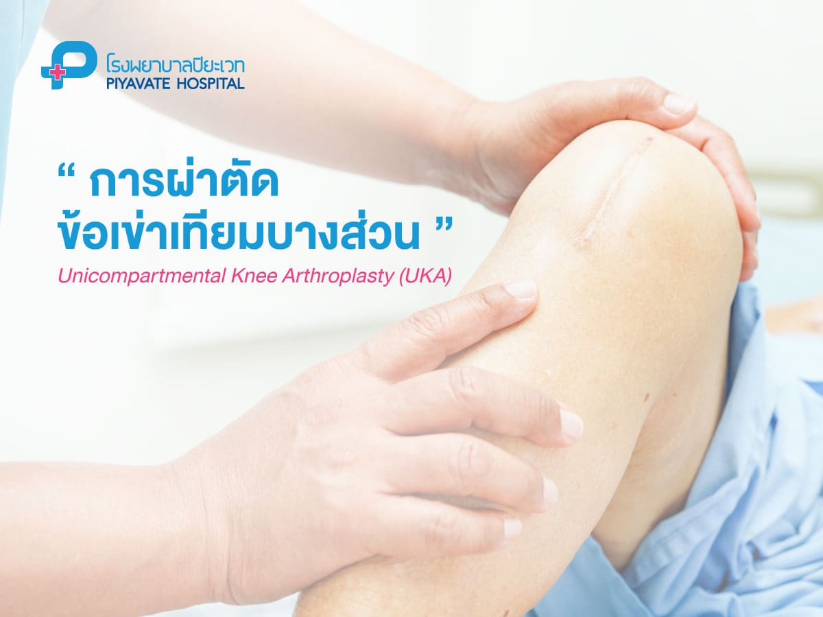 การผ่าตัดข้อเข่าเทียมบางส่วน