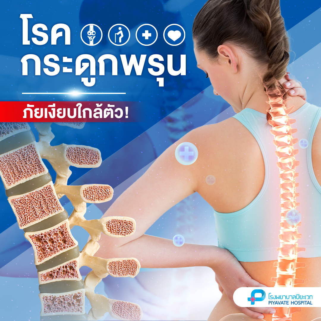 โรคกระดูกพรุน ภัยเงียบใกล้ตัว