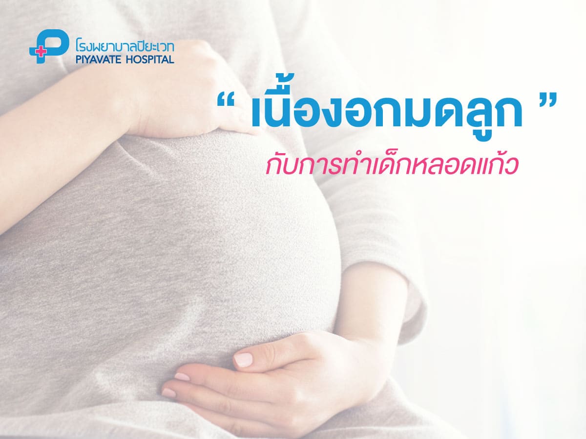 เนื้องอกมดลูกกับการทำเด็กหลอดแก้ว