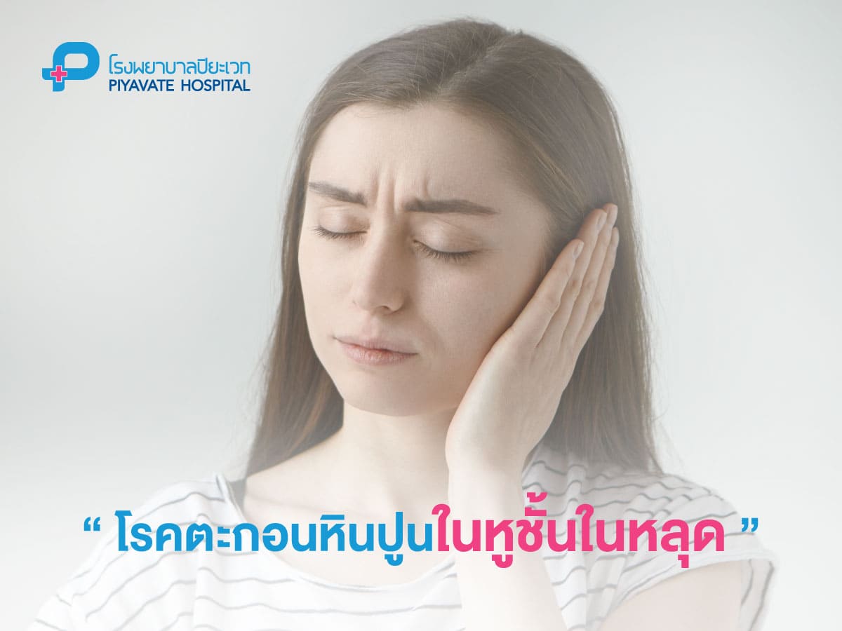 โรคตะกอนหินปูนในหูชั้นในหลุด