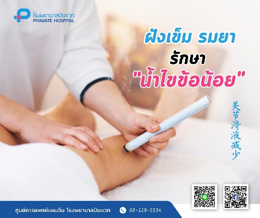 แพทย์แผนจีน : ฝังเข็ม รมยา “น้ำไขข้อน้อย” 关节滑液减少
