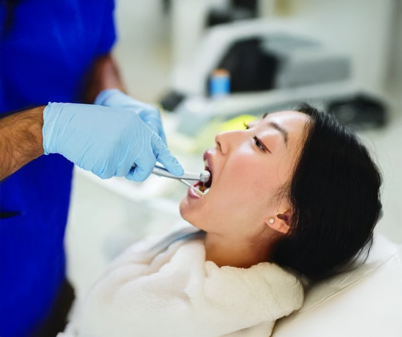 Dental Sealants