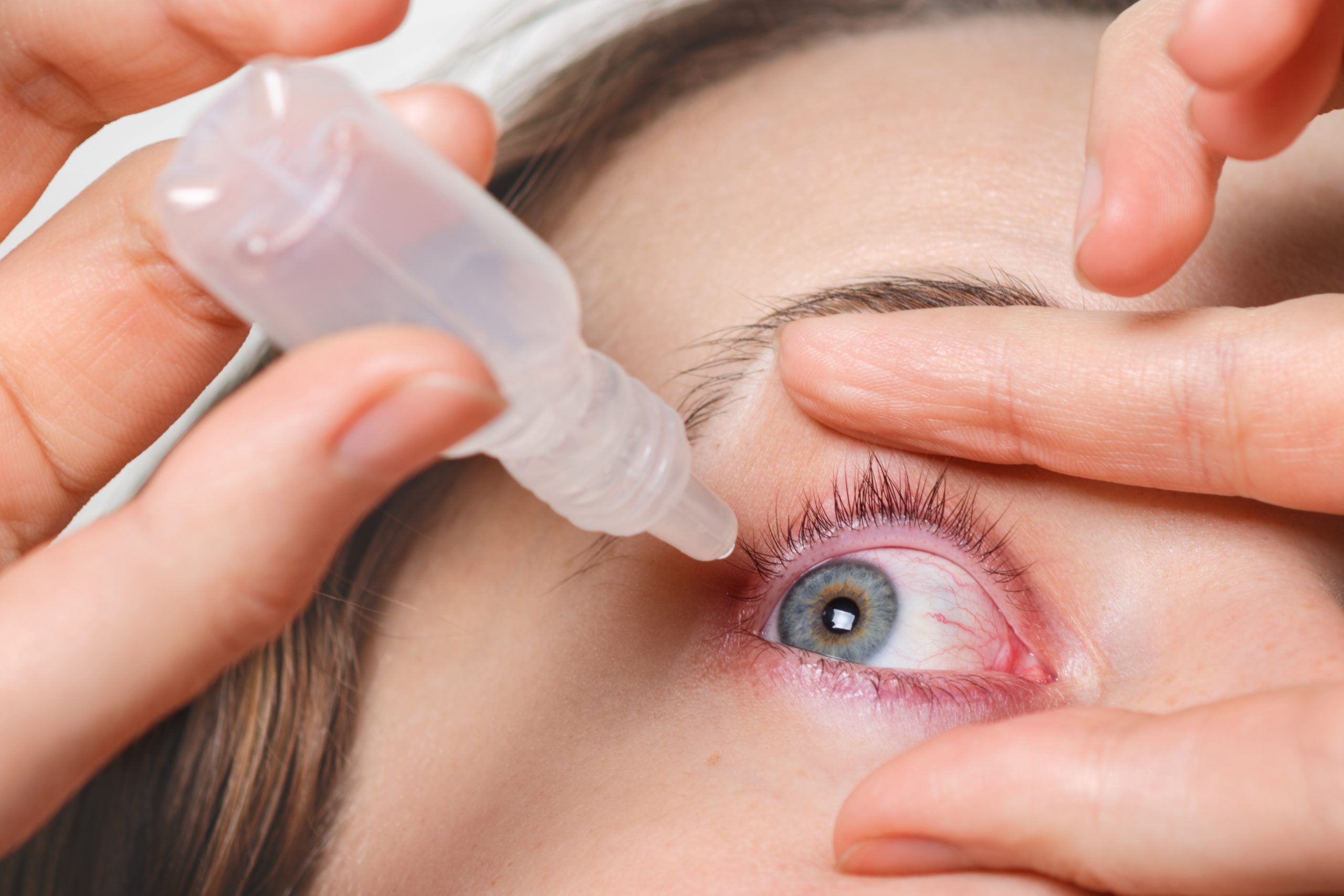 โรคตาแห้ง (Dry eye)
