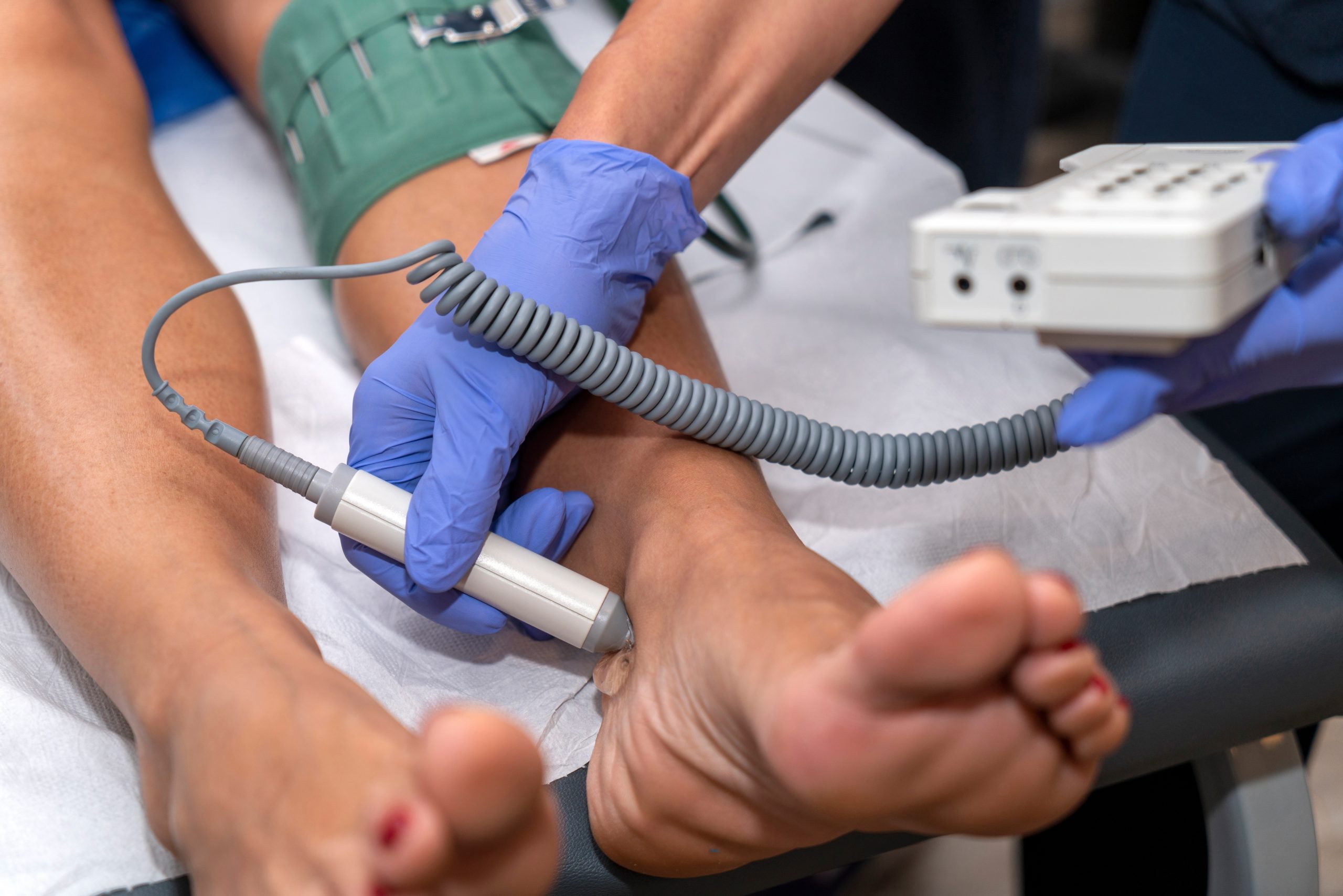 ความสำคัญของการตรวจ ABI (Ankle Brachial Index)
