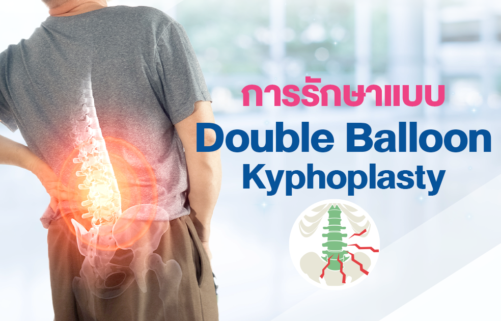 การรักษาแบบ Double Balloon Kyphoplasty